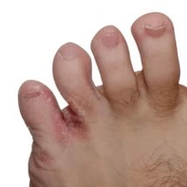 Pilz zwischen den Fingern