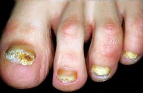 Charakterisierung der Krankheit