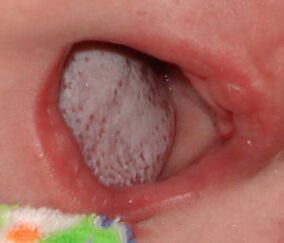 Lokalisierung der Krankheit mit einem Pilz